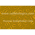 Human Primary Colonic Microvascular Endothelial Cells – Figure 1 of 1
