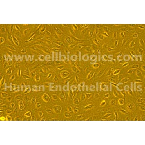 Human Primary Bladder Microvascular Endothelial Cells – Figure 1 of 1
