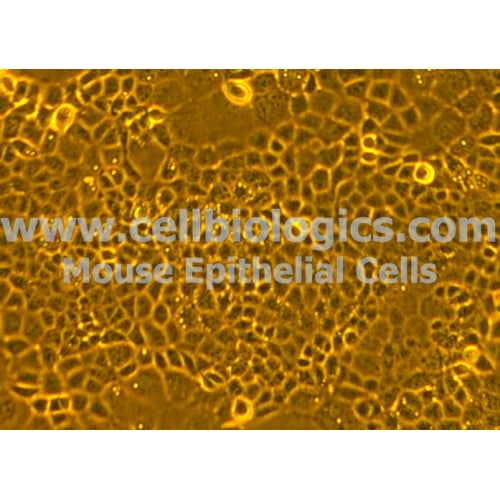 Diabetic Mouse Prostate Epithelial Cells – Figure 1 of 1
