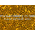 Diabetic Mouse Pancreatic Epithelial Cells – Figure 1 of 1