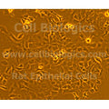 ZDF Rat Diabetic Corneal Epithelial Cells – Figure 1 of 1