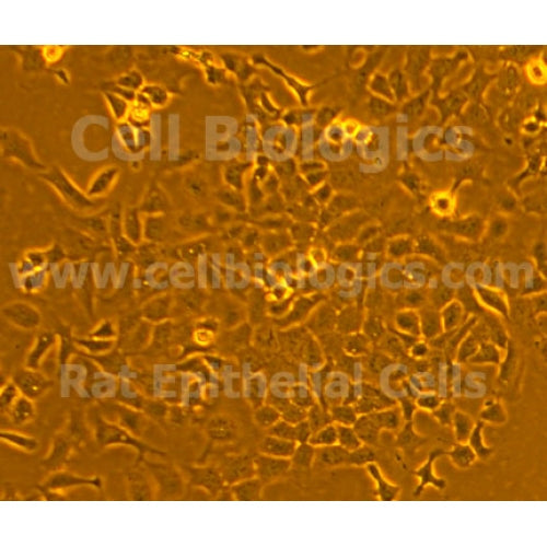 ZDF Rat Diabetic Corneal Epithelial Cells – Figure 1 of 1