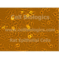Diabetic Mouse Alveolar Epithelial Cells – Figure 1 of 1
