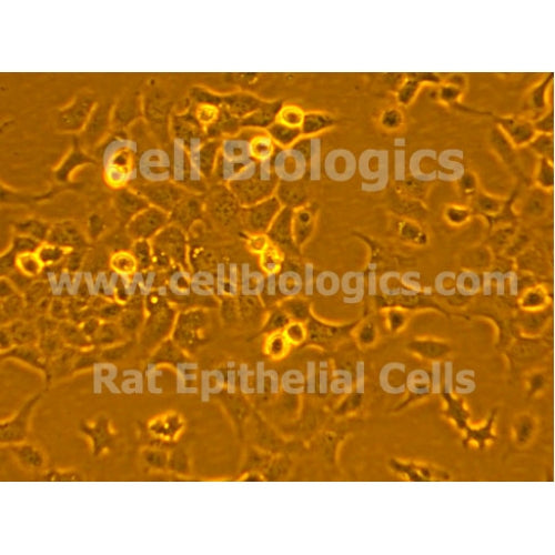 Diabetic Mouse Alveolar Epithelial Cells – Figure 1 of 1