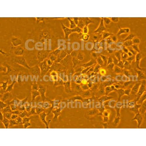 ZDF Rat Diabetic Pancreatic Epithelial Cells – Figure 1 of 1