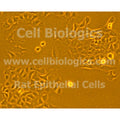 ZDF Rat Diabetic Esophageal Epithelial Cells – Figure 1 of 1