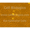 ZDF Rat Diabetic Ovarian Epithelial Cells – Figure 1 of 1