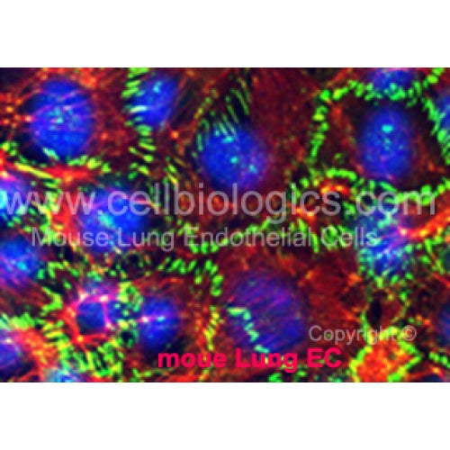 C57BL/6 Mouse Primary Prostate Microvascular Endothelial Cells – Figure 1 of 1