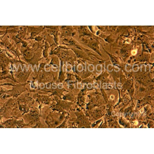 Human Primary Diabetic Kidney Vein Fibroblasts – Figure 1 of 1