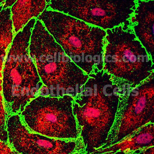 Human Primary Pancreatic Microvascular Endothelial Cells – Figure 1 of 1