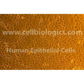 Human Liver Tumor Epithelial Cells – Figure 1 of 1