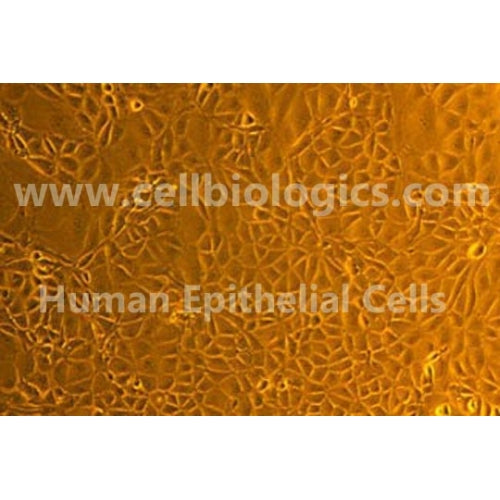 Human Liver Tumor Epithelial Cells – Figure 1 of 1