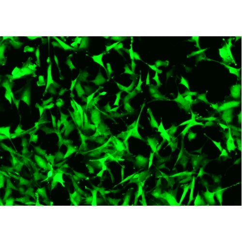 ZDF Rat Diabetic Artery Fibroblasts – Figure 1 of 1