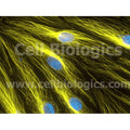 Human Primary Thyroid Microvascular Endothelial Cells – Figure 1 of 1