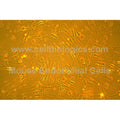 Diabetic Mouse Vein Endothelial Cells – Figure 1 of 1