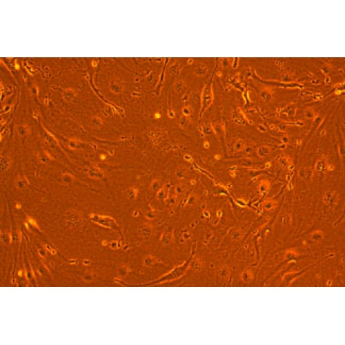 Diabetic Mouse Lung Microvascular Endothelial Cells – Figure 1 of 1
