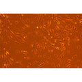 Diabetic Mouse Prostate Microvascular Endothelial Cells – Figure 1 of 1