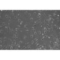 Diabetic Mouse Ovarian Microvascular Endothelial Cells – Figure 1 of 1