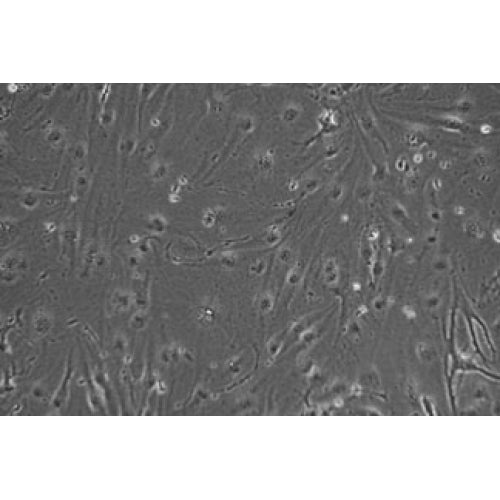Diabetic Mouse Small Intestinal Microvascular Endothelial Cells – Figure 1 of 1
