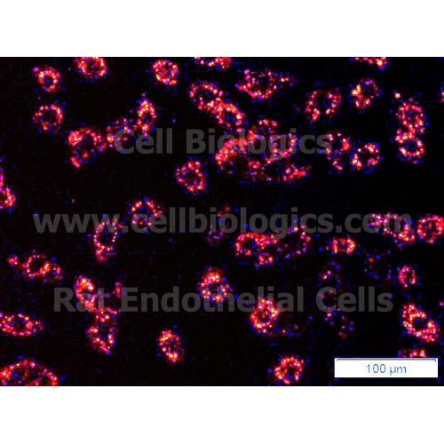 Rat Primary Pulmonary Artery Endothelial Cells – Figure 1 of 1