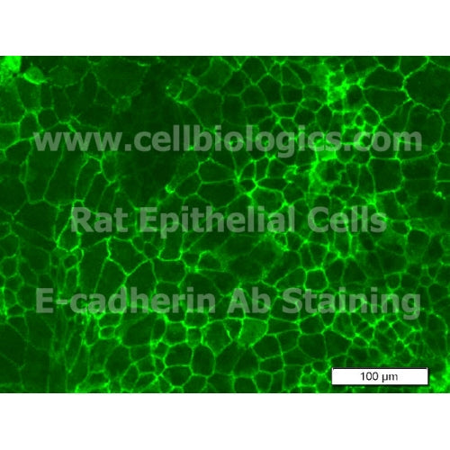 Rat Primary Alveolar Epithelial Cells – Figure 1 of 1