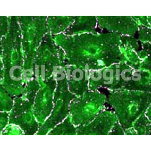 Diabetic Mouse Kidney Epithelial Cells – Figure 1 of 1