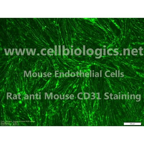 BKS db Mouse Retinal Microvascular Endothelial Cells – Figure 1 of 1