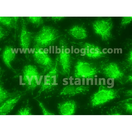 Human Primary Dermal Lymphatic Endothelial Cells – Figure 1 of 1