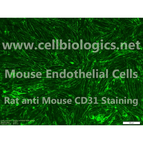 C57BL/6-GFP Mouse Primary Dermal Lymphatic Endothelial Cells – Figure 1 of 1
