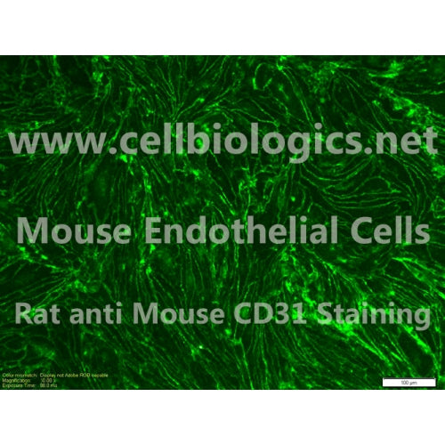 BALB/c Mouse Primary Lymphatic Endothelial Cells – Figure 1 of 1