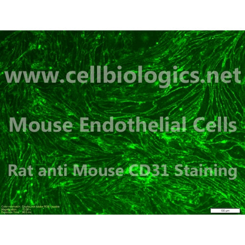 C57BL/6 Mouse Primary Pulmonary Vein Endothelial Cells – Figure 1 of 1