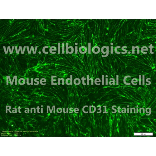 C57BL/6 Mouse Primary Thyroid Microvascular Endothelial Cells – Figure 1 of 1