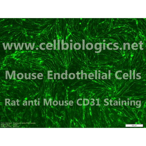 C57BL/6-GFP Mouse Primary Mammary Microvascular Endothelial Cells – Figure 1 of 1