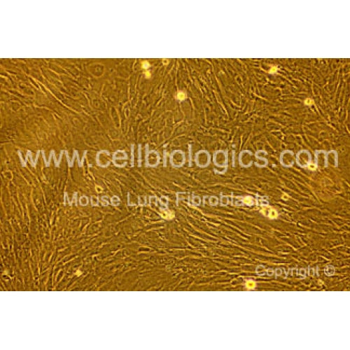 Diabetic Mouse Lung Fibroblasts – Figure 1 of 1