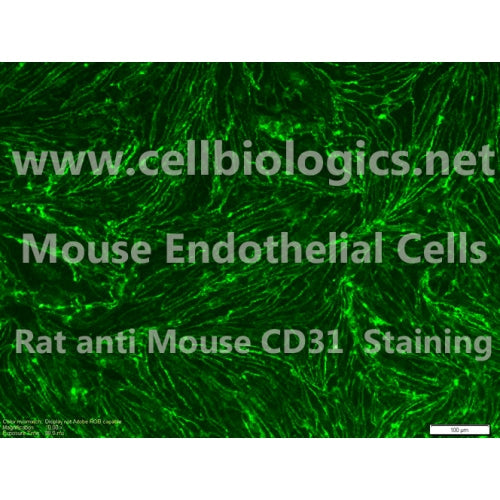 C57BL/6-GFP Mouse Primary Pulmonary Artery Endothelial Cells – Figure 1 of 1
