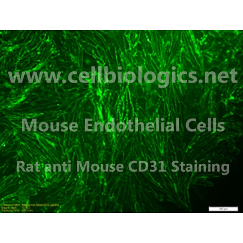 BKS db Control Mouse Bone Marrow-Derived Endothelial Cells – Figure 1 of 1