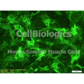 Diabetic Mouse Ovarian Smooth Muscle Cells – Figure 1 of 1