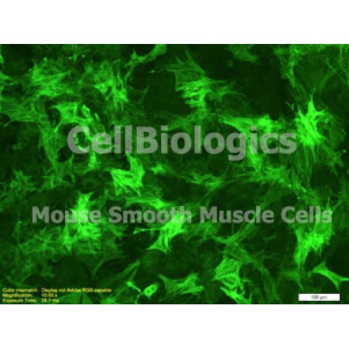 Diabetic Mouse Ovarian Smooth Muscle Cells – Figure 1 of 1