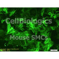 Diabetic Mouse Prostate Smooth Muscle Cells – Figure 1 of 1