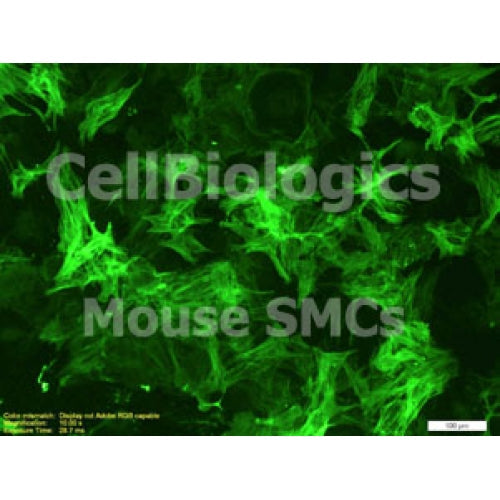 Diabetic Mouse Prostate Smooth Muscle Cells – Figure 1 of 1