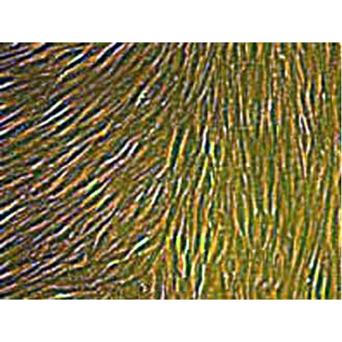 Human Primary Diabetic Liver Vein Smooth Muscle Cells – Figure 1 of 1