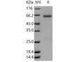 Recombinant Human TRIB3/TRB3 Protein (GST Tag) – Figure 1 of 2