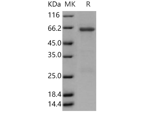 Recombinant Human TRIB3/TRB3 Protein (GST Tag) – Figure 1 of 2