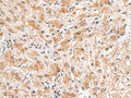PDCL2 Polyclonal Antibody – Figure 1 of 2