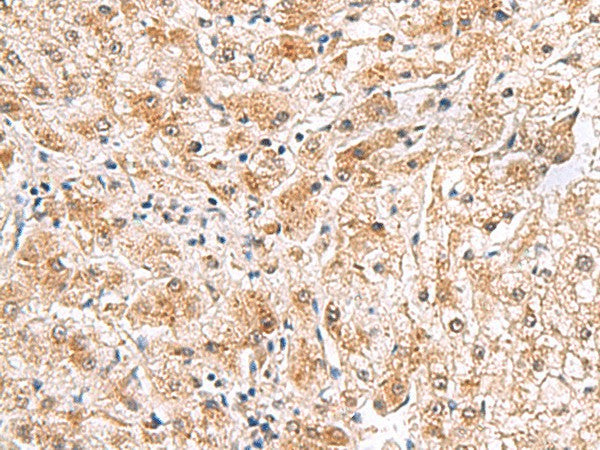 PDCL2 Polyclonal Antibody – Figure 1 of 2