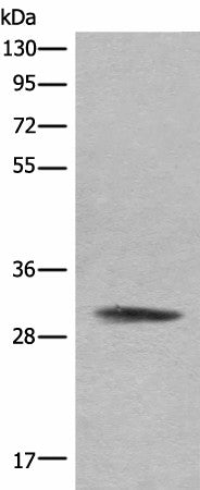 COMT Polyclonal Antibody – Figure 1 of 4