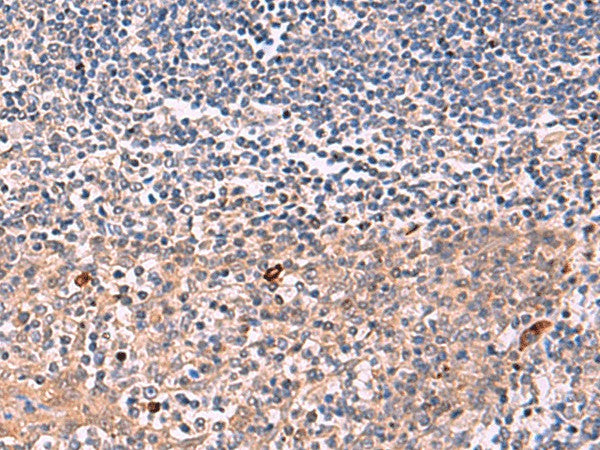 IFNA1/IFNA13 Polyclonal Antibody – Figure 1 of 2