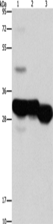 KHK Polyclonal Antibody – Figure 1 of 2