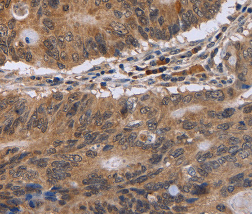 EIF3H Polyclonal Antibody – Figure 1 of 3