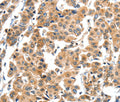 XBP1 Polyclonal Antibody – Figure 1 of 3